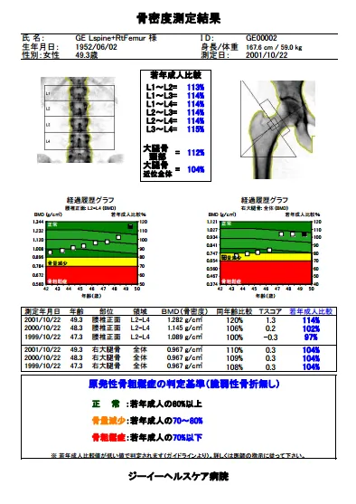 骨密度測定結果